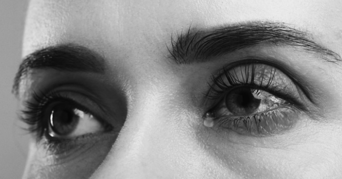 dry eye image
